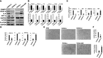 High <mark class="highlighted">DNMT1</mark> Expression in Stromal Fibroblasts Promotes Angiogenesis and Unfavorable Outcome in Locally Advanced Breast Cancer Patients